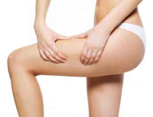 Scopri di più sull'articolo Cellulite ed allenamento